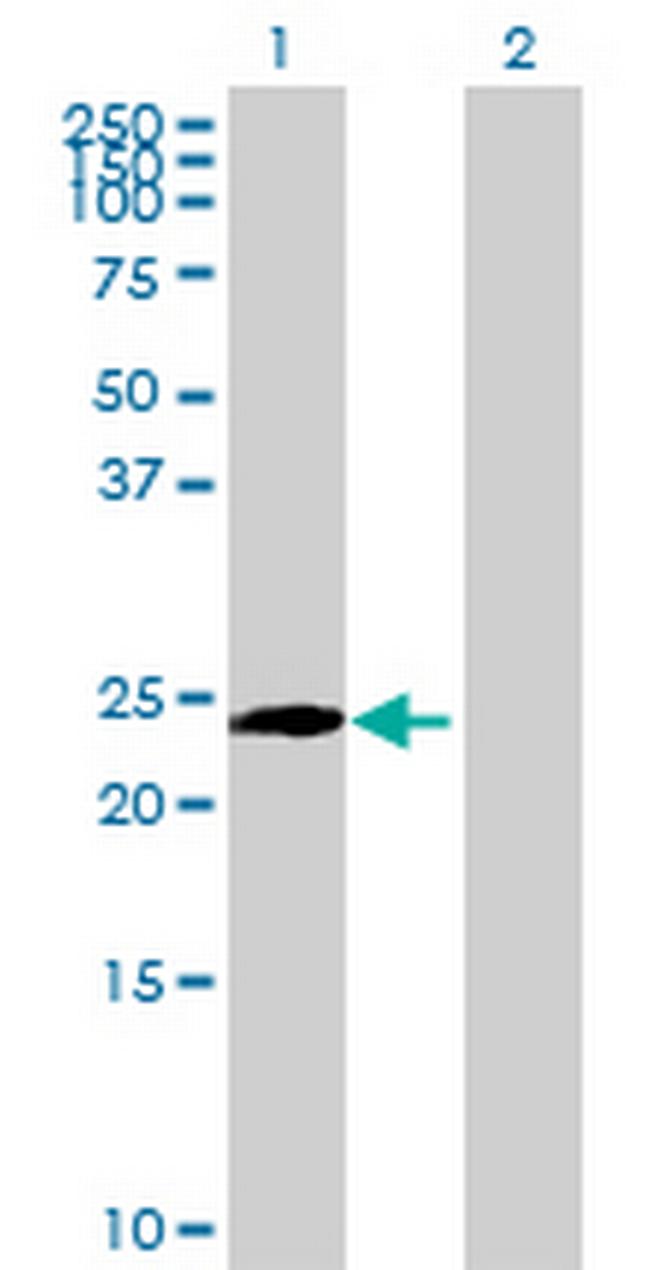 PIP5K1C Antibody in Western Blot (WB)