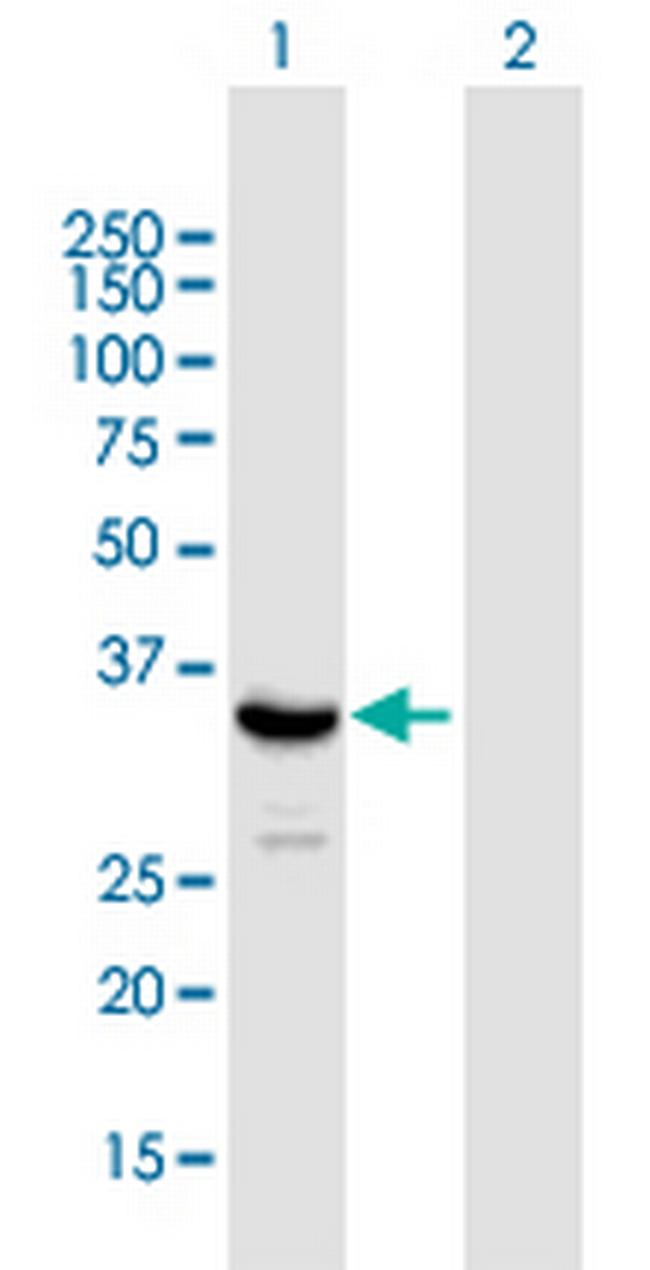 SIRT4 Antibody in Western Blot (WB)