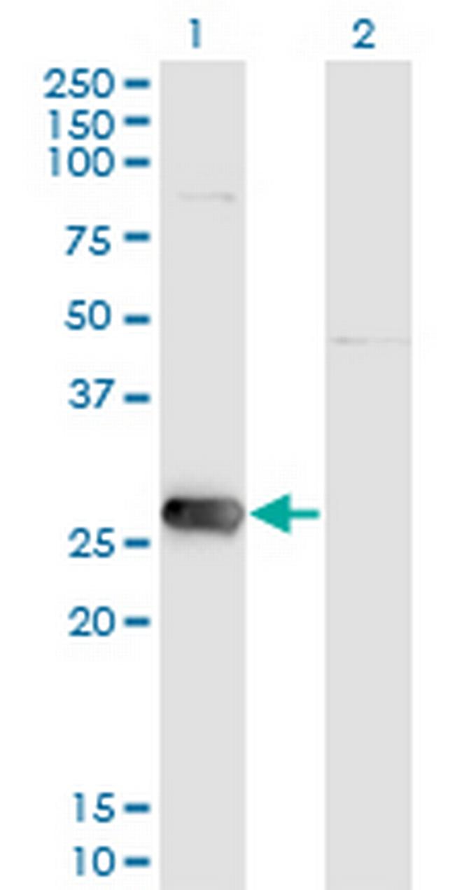 SIRT3 Antibody in Western Blot (WB)