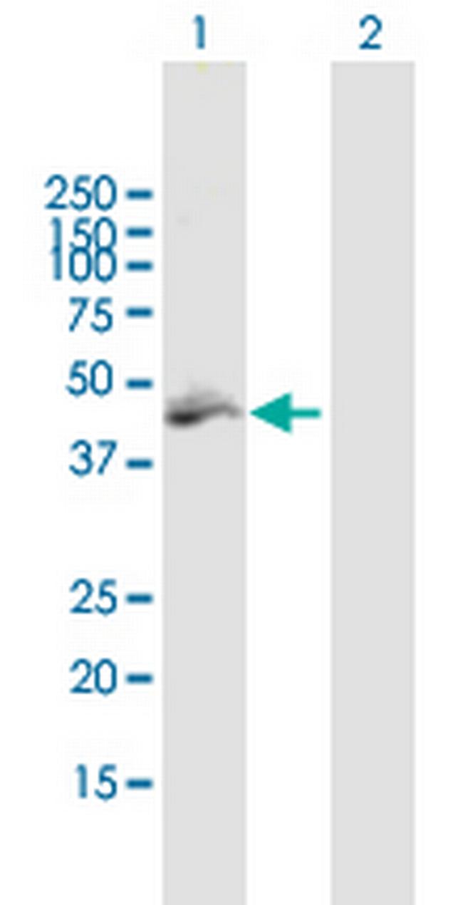 MLYCD Antibody in Western Blot (WB)