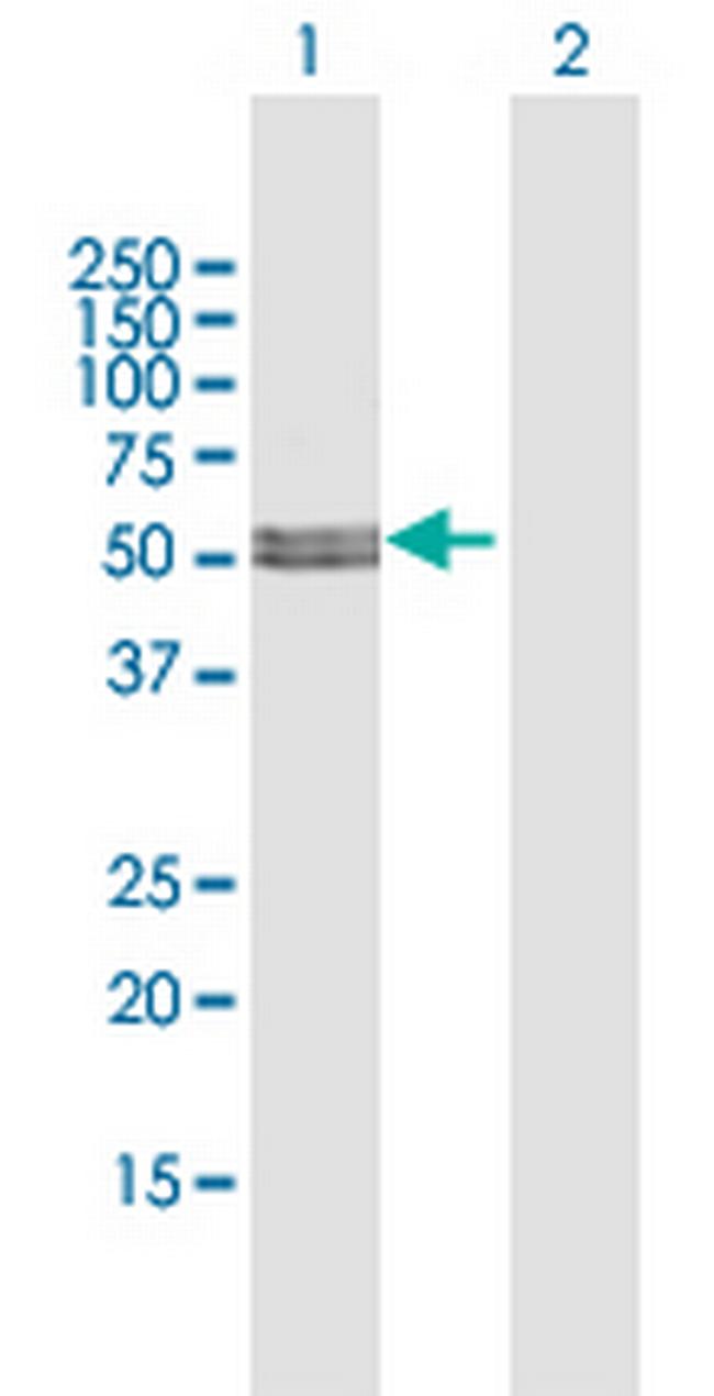 MLYCD Antibody in Western Blot (WB)