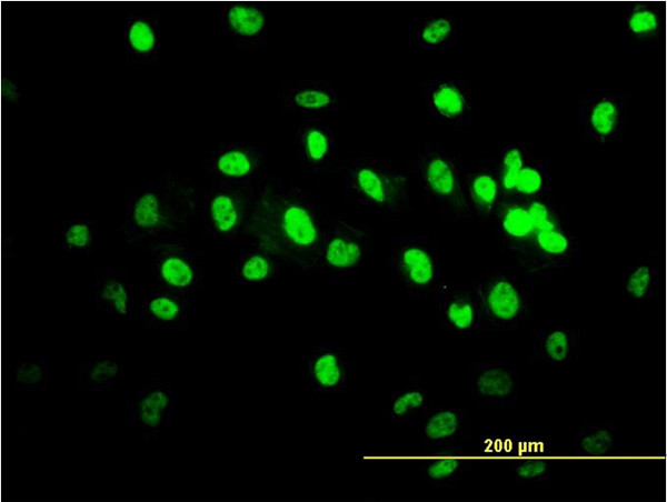 TARDBP Antibody in Immunocytochemistry (ICC/IF)