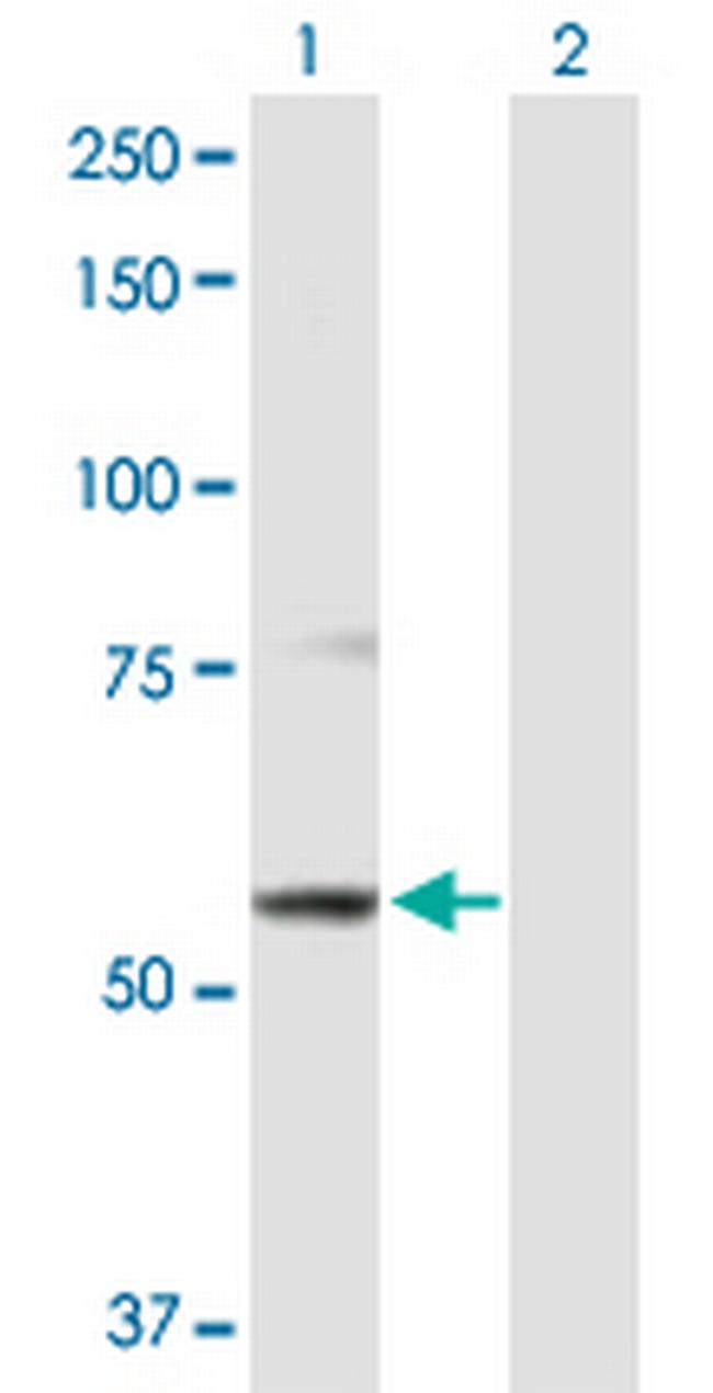 ABCB9 Antibody in Western Blot (WB)