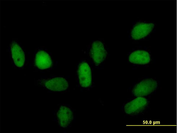 CBX5 Antibody in Immunocytochemistry (ICC/IF)