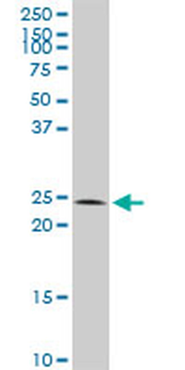 CBX5 Antibody in Western Blot (WB)