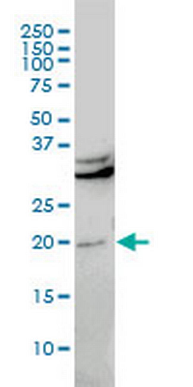 CBX5 Antibody in Western Blot (WB)