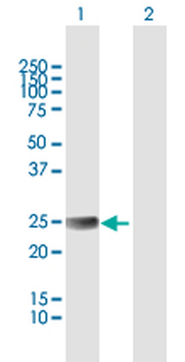 ETHE1 Antibody in Western Blot (WB)