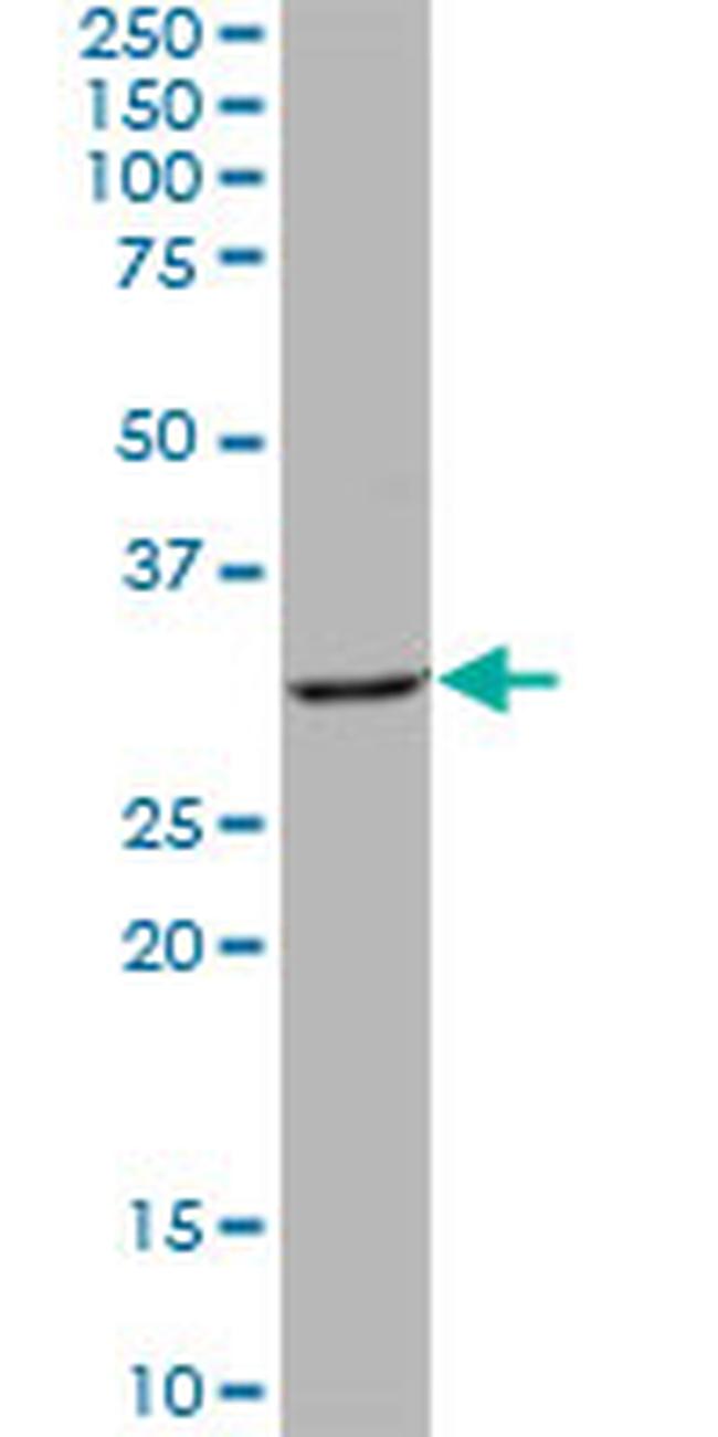 QPRT Antibody in Western Blot (WB)