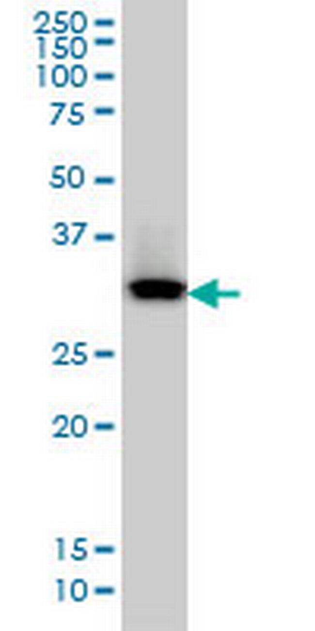 QPRT Antibody in Western Blot (WB)