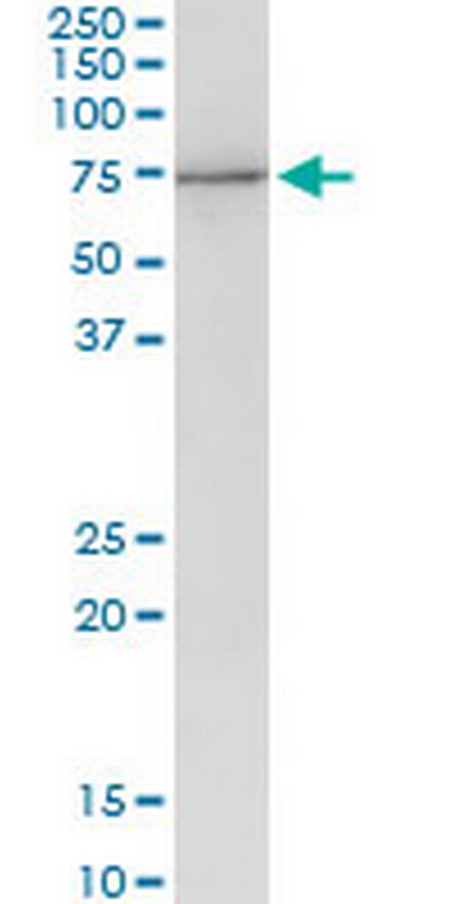 PES1 Antibody in Western Blot (WB)