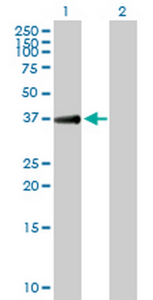 TGDS Antibody in Western Blot (WB)