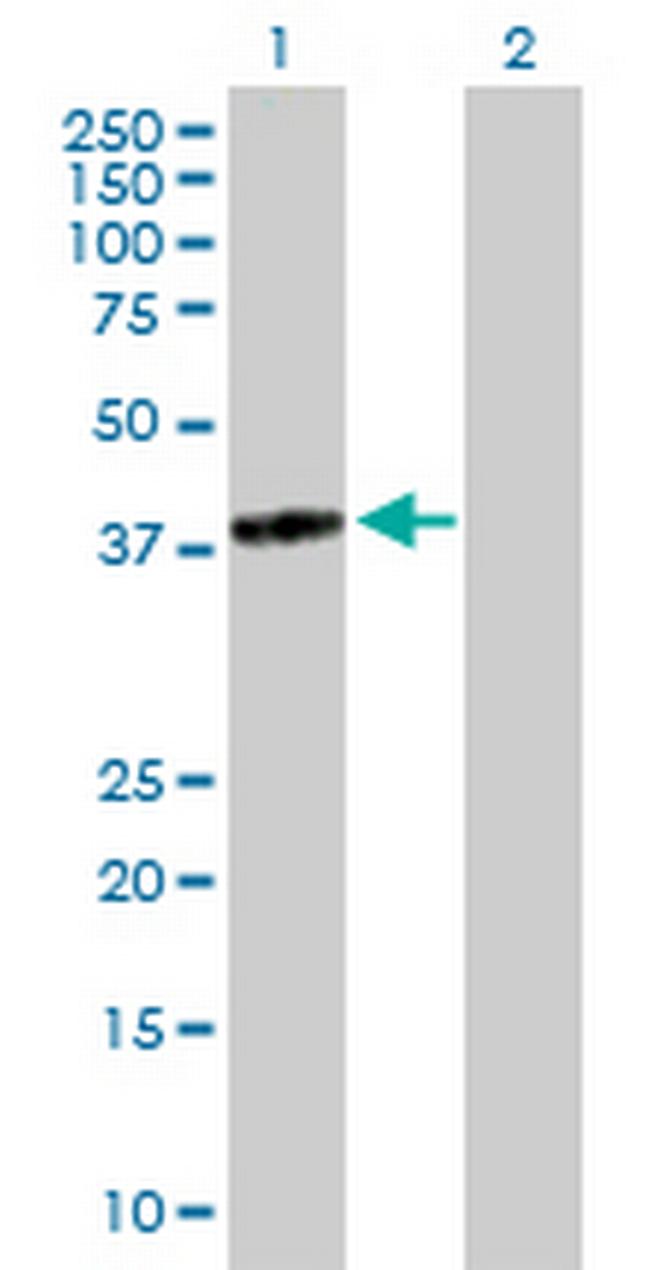 TGDS Antibody in Western Blot (WB)