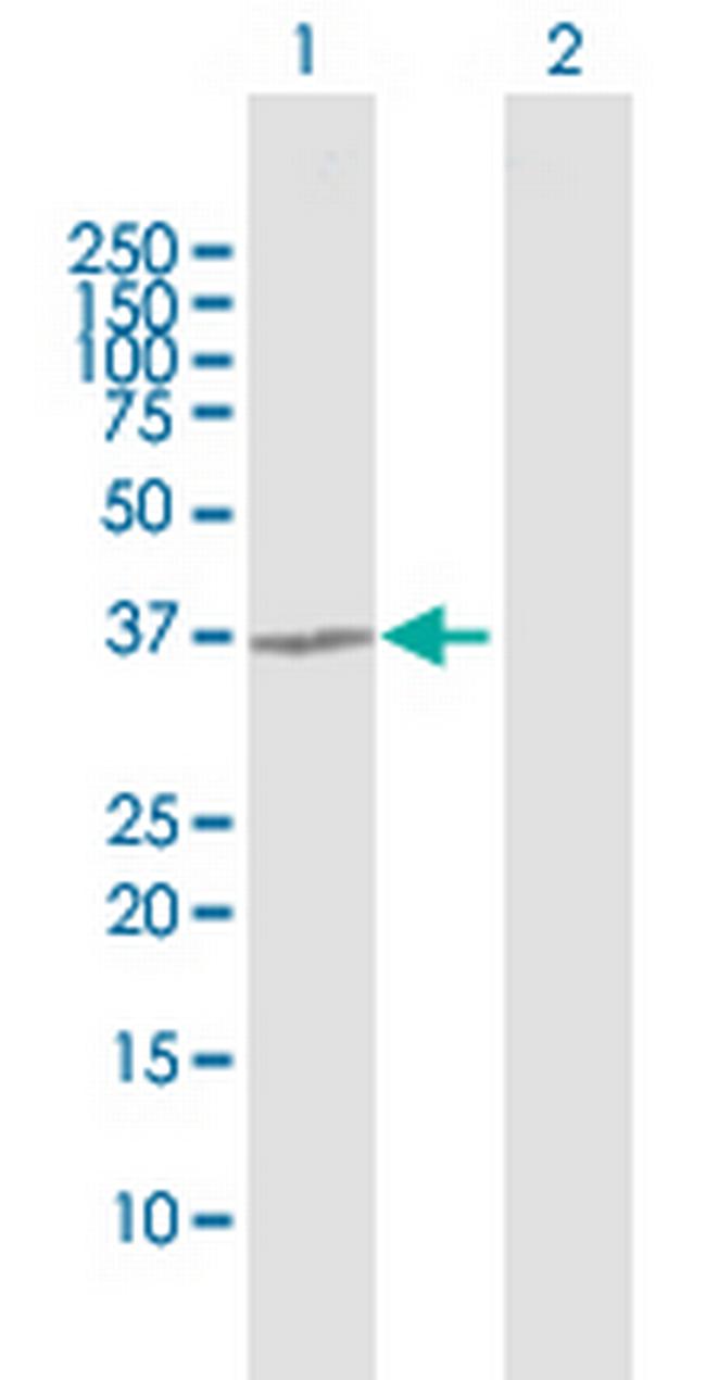 TGDS Antibody in Western Blot (WB)