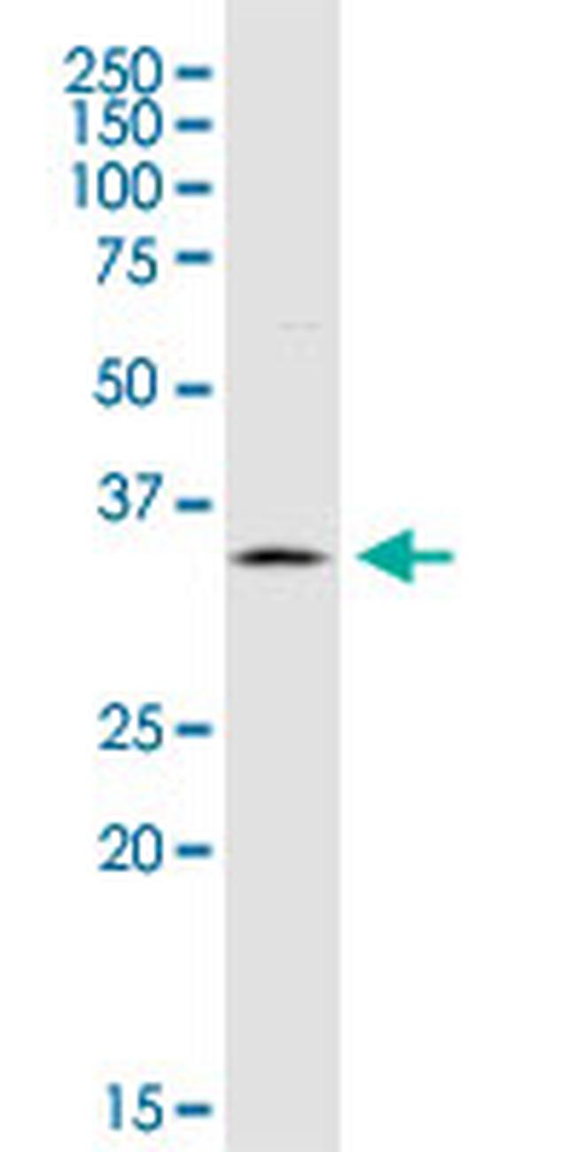 TNFRSF13B Antibody in Western Blot (WB)