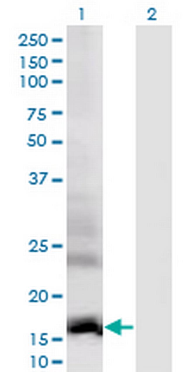 DAAM2 Antibody in Western Blot (WB)