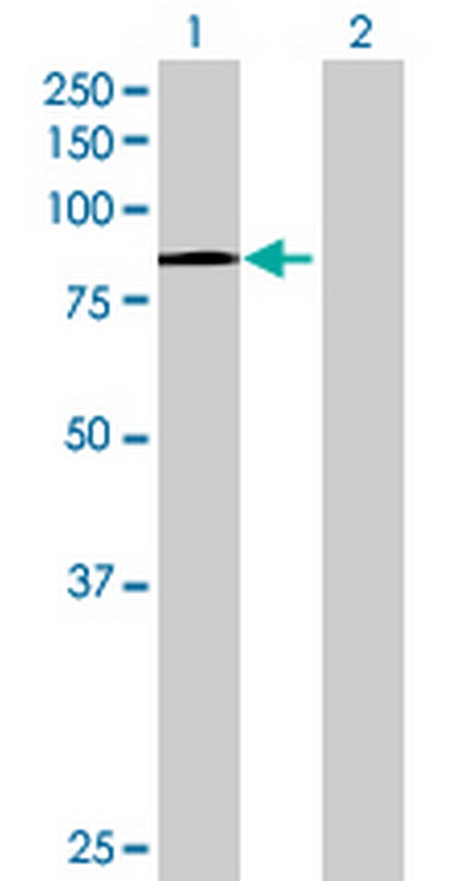 CENTB2 Antibody in Western Blot (WB)