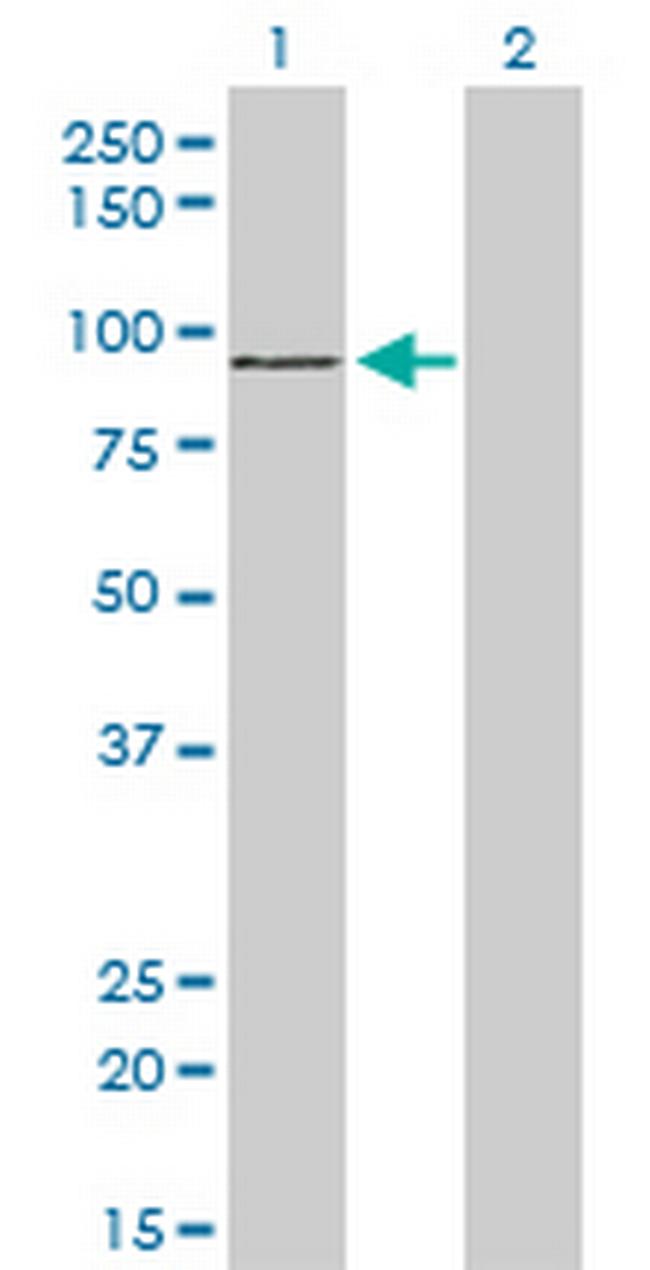 ZNF281 Antibody in Western Blot (WB)