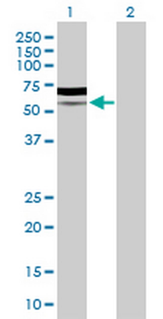 PIK3R5 Antibody in Western Blot (WB)