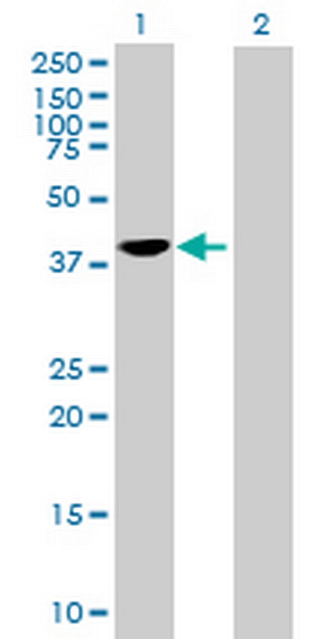 SEC14L2 Antibody in Western Blot (WB)