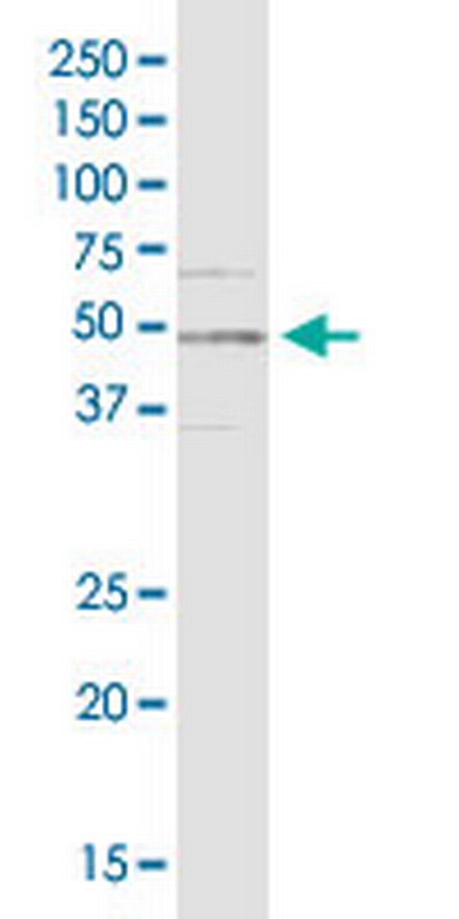 RBM9 Antibody in Western Blot (WB)