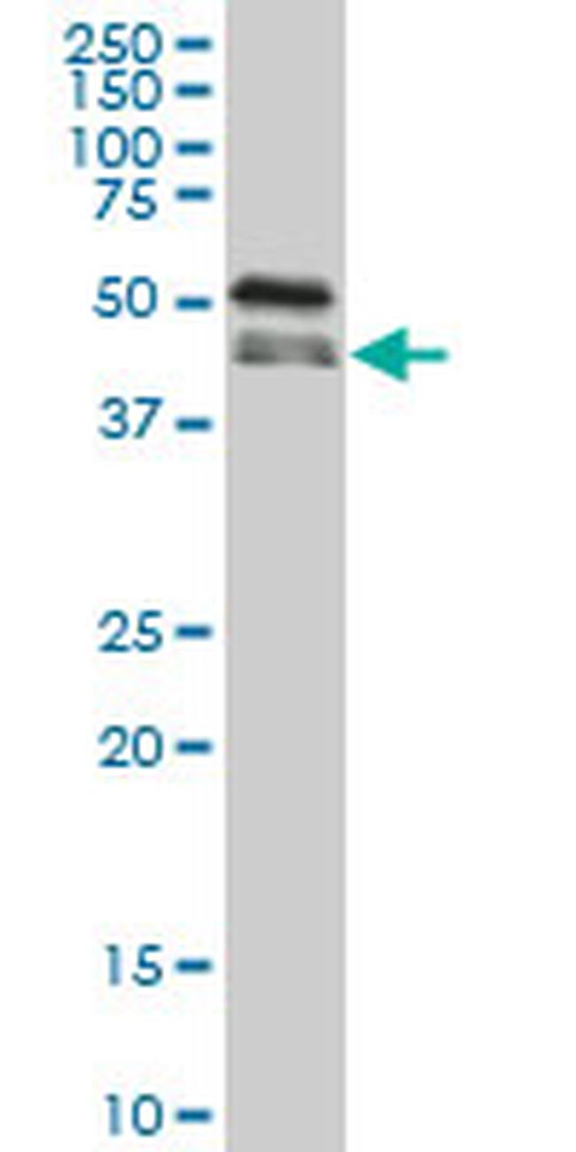 RBM9 Antibody in Western Blot (WB)
