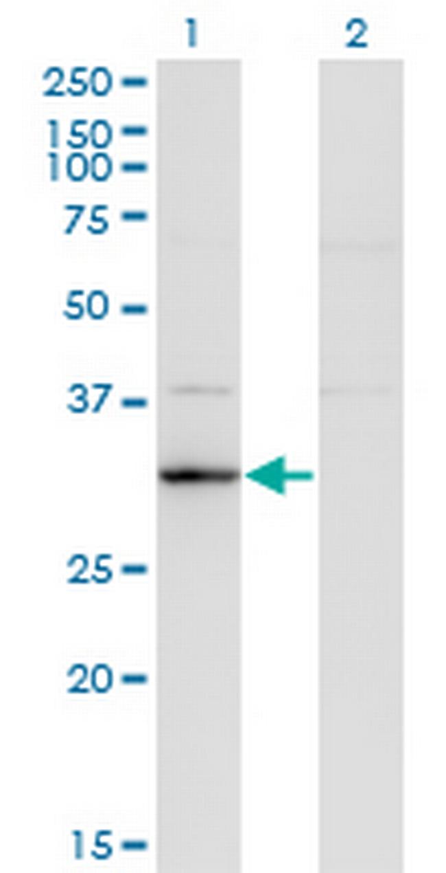 RASD2 Antibody in Western Blot (WB)