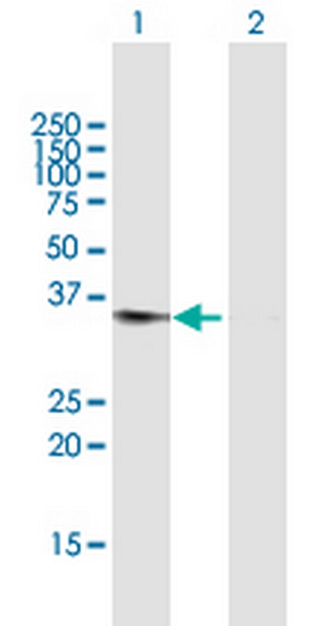 DDAH1 Antibody in Western Blot (WB)