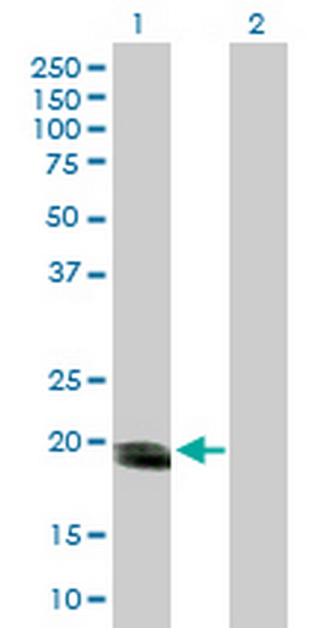 SMUG1 Antibody in Western Blot (WB)