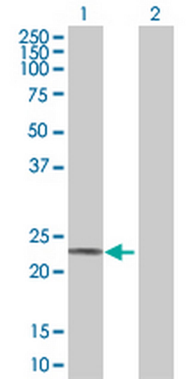 ACOT9 Antibody in Western Blot (WB)