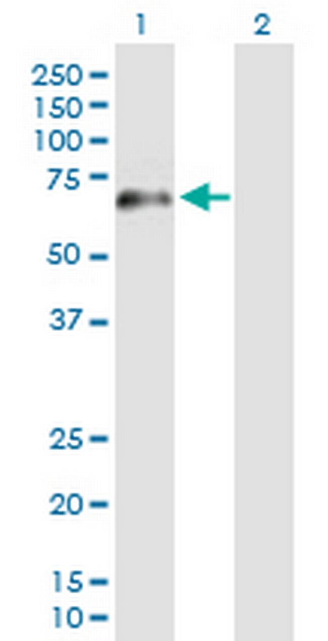 ZNF278 Antibody in Western Blot (WB)