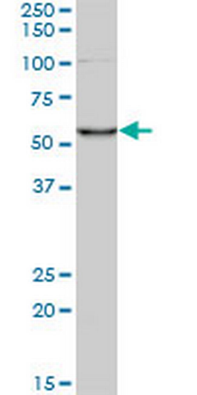 CORO1C Antibody in Western Blot (WB)