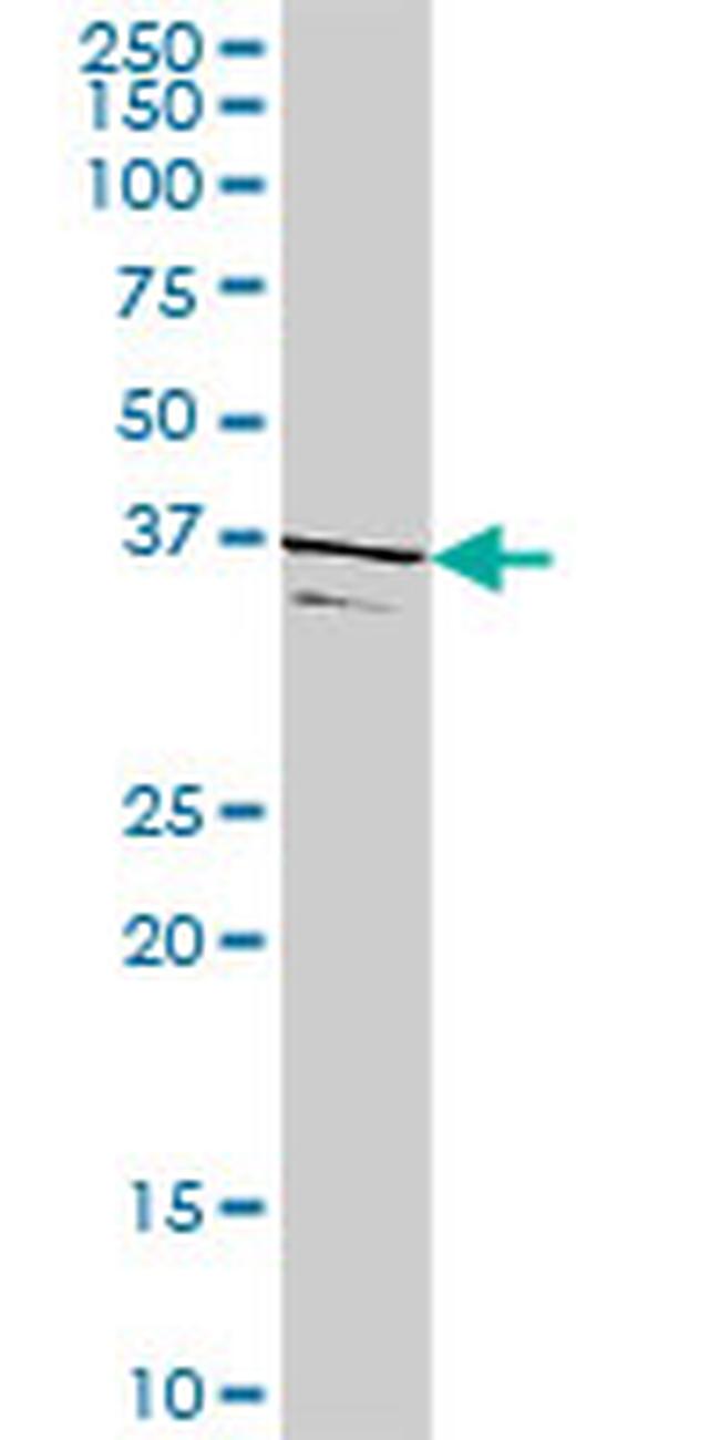 TSSK2 Antibody in Western Blot (WB)