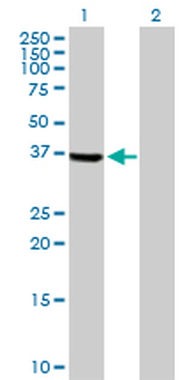 TSSK2 Antibody in Western Blot (WB)