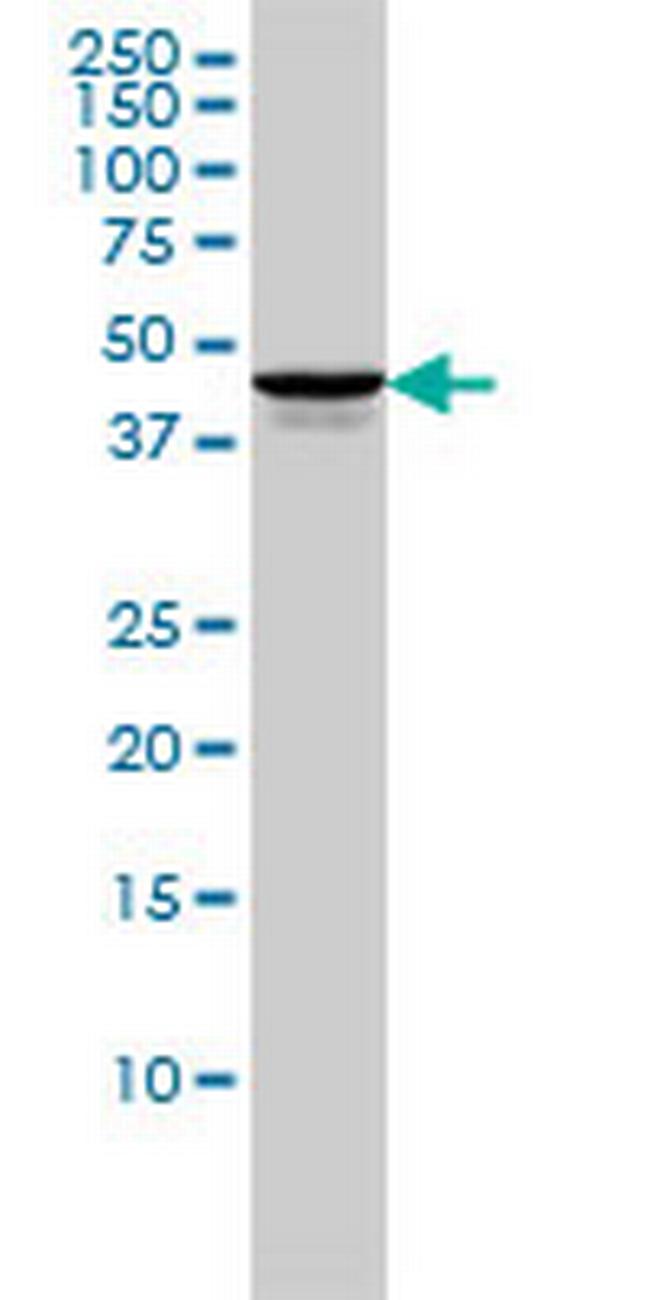 TSSK2 Antibody in Western Blot (WB)