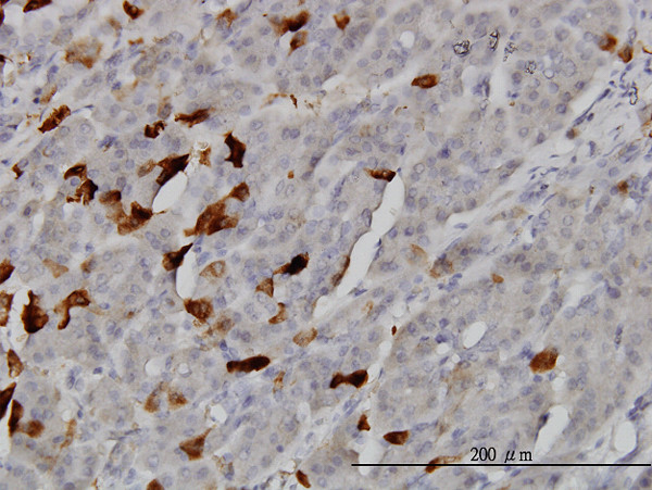 TSSK2 Antibody in Immunohistochemistry (Paraffin) (IHC (P))