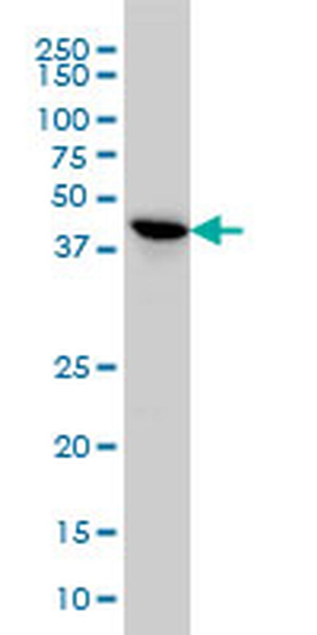 TSSK2 Antibody in Western Blot (WB)