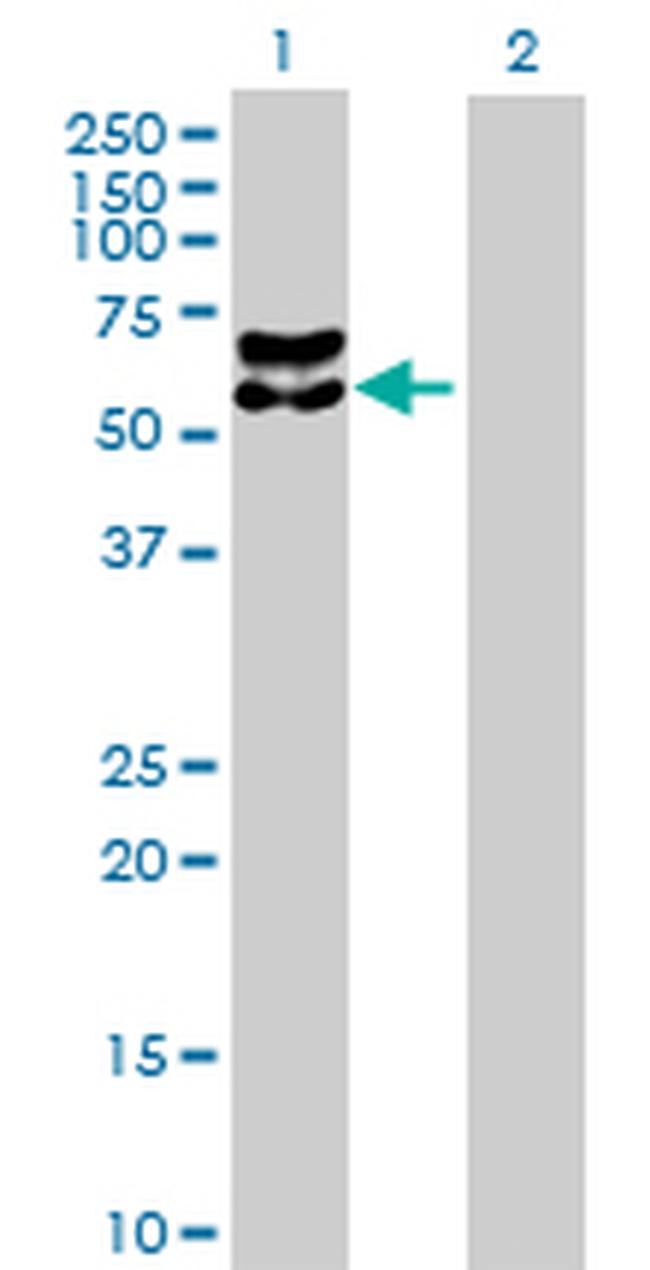 BACE1 Antibody in Western Blot (WB)