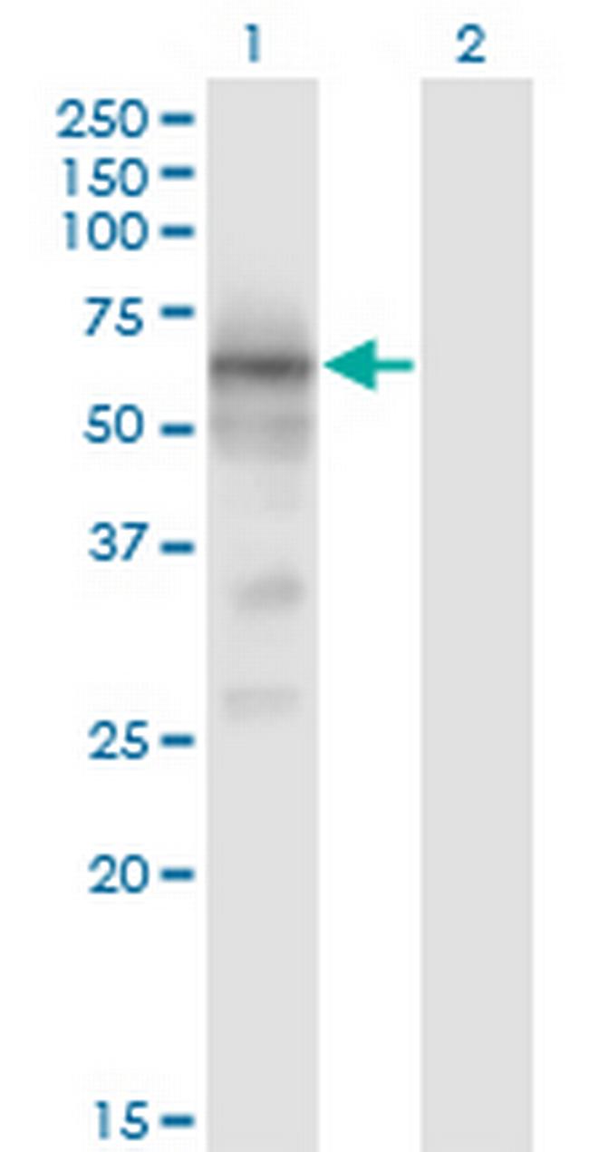 BACE1 Antibody in Western Blot (WB)