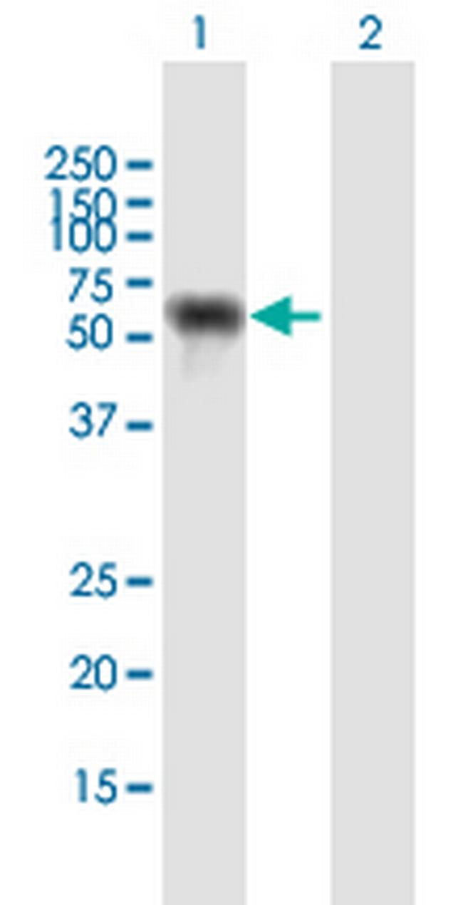 NUP62 Antibody in Western Blot (WB)