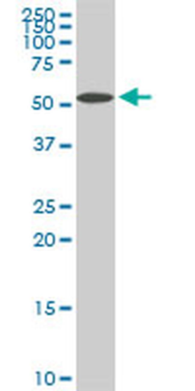 NUP62 Antibody in Western Blot (WB)