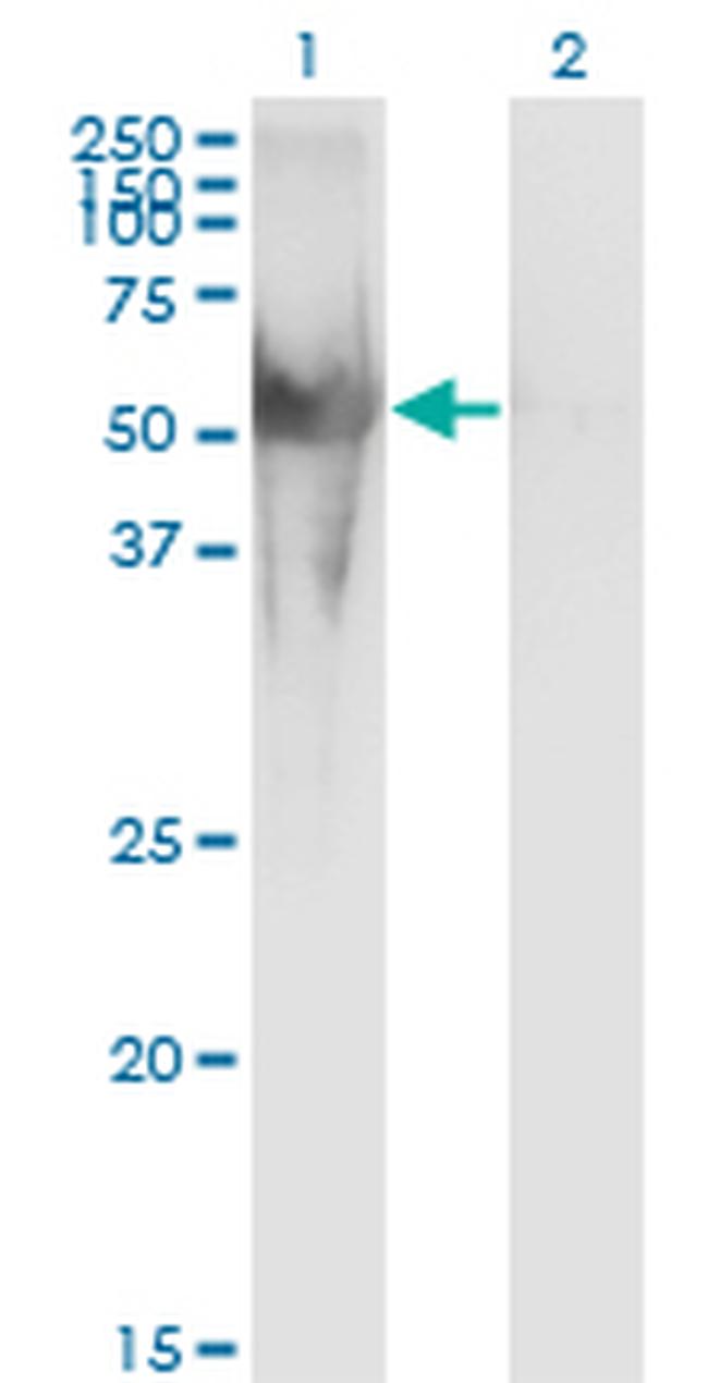 NUP62 Antibody in Western Blot (WB)