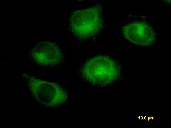 RABGAP1 Antibody in Immunocytochemistry (ICC/IF)