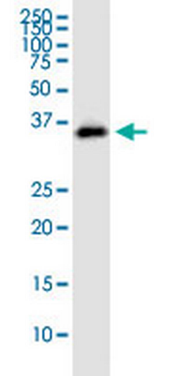 STX12 Antibody in Western Blot (WB)