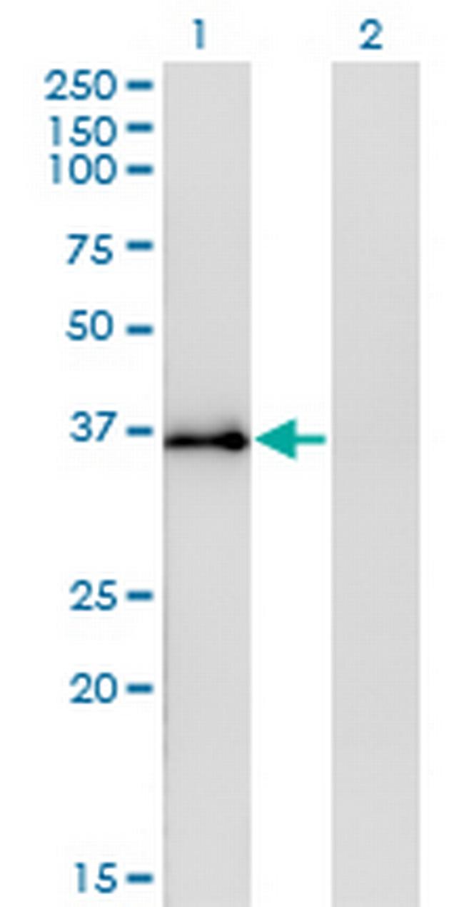 STX12 Antibody in Western Blot (WB)