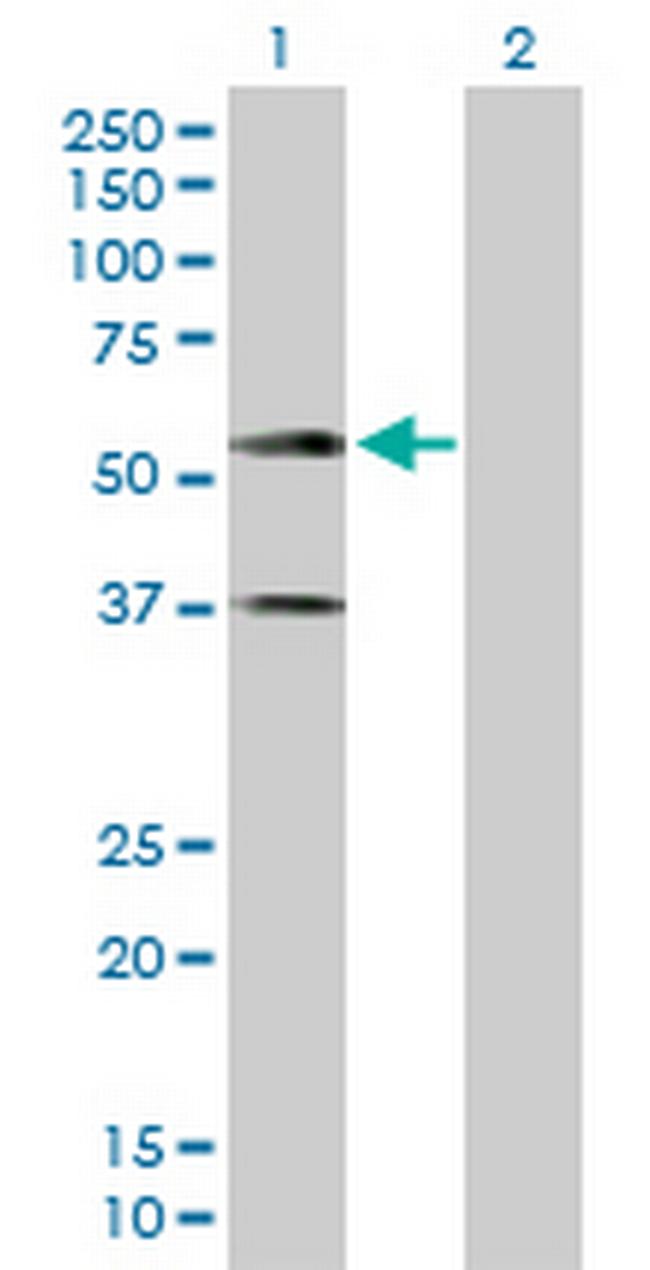 CADM1 Antibody in Western Blot (WB)