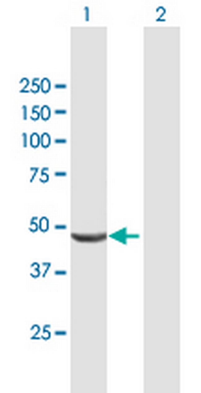 SHPK Antibody in Western Blot (WB)