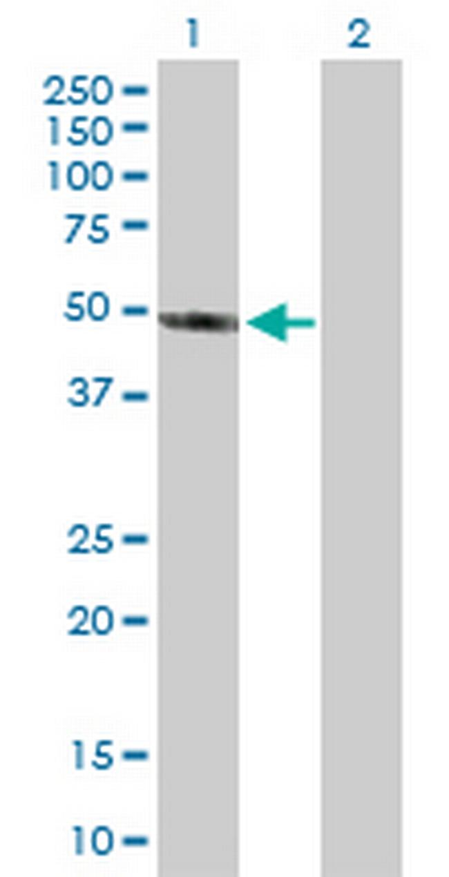 AIPL1 Antibody in Western Blot (WB)