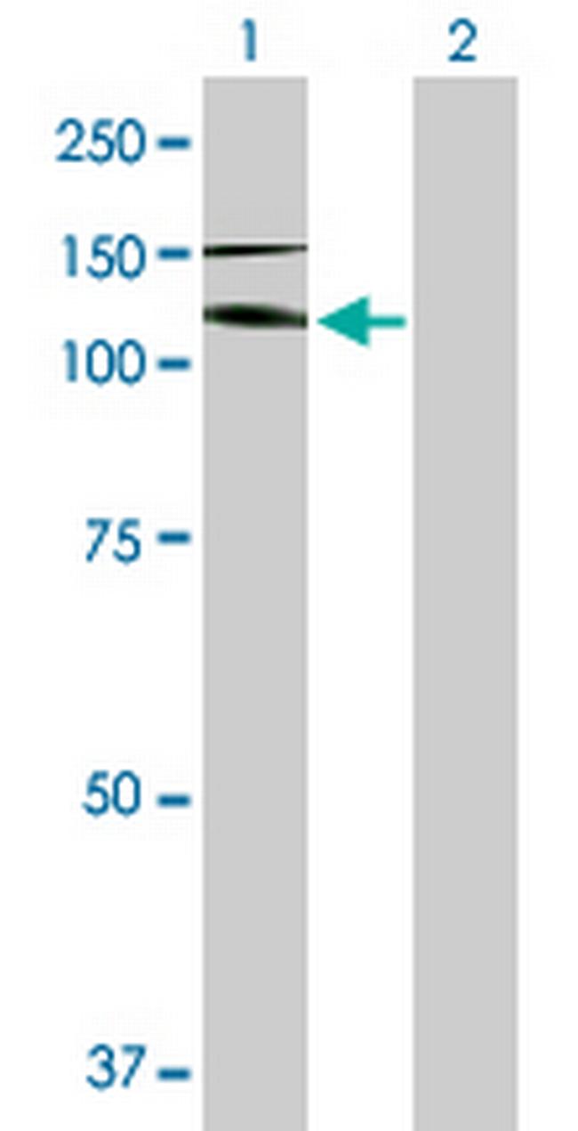 IL17RA Antibody in Western Blot (WB)