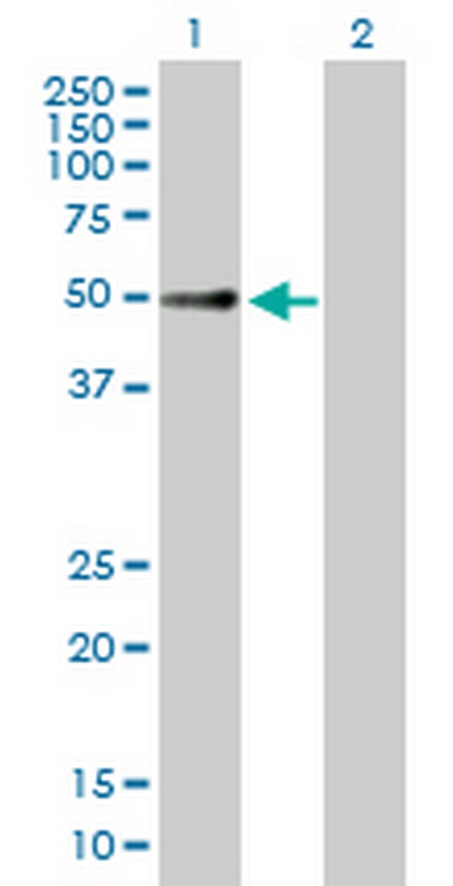 FKBP8 Antibody in Western Blot (WB)