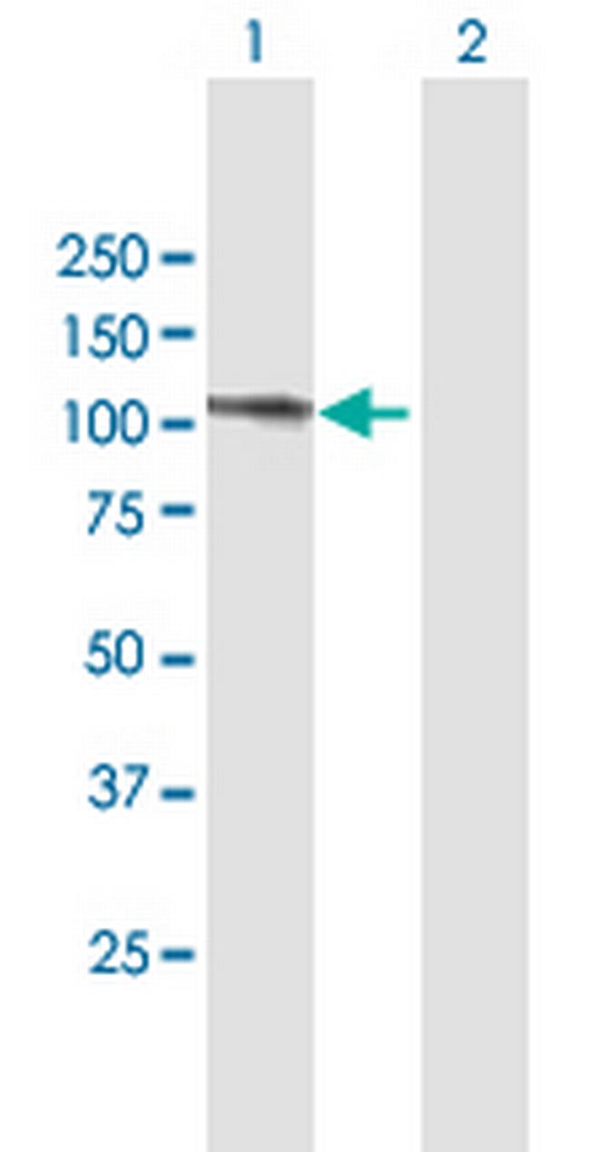 C20orf14 Antibody in Western Blot (WB)